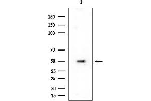 anti-Cold Shock Domain Protein A (CSDA) antibody