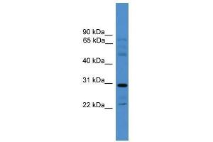 Western Blot showing GJC3 antibody used at a concentration of 1-2 ug/ml to detect its target protein. (GJC3 antibody  (Middle Region))