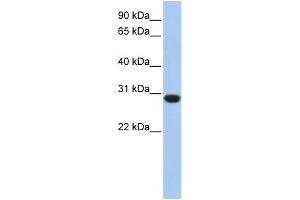 WB Suggested Anti-ASB12 Antibody Titration: 0.