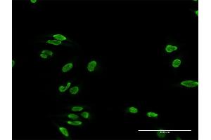 Immunofluorescence of purified MaxPab antibody to TDP1 on HeLa cell. (TDP1 antibody  (AA 1-608))