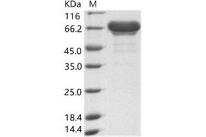 Western Blotting (WB) image for Ebola Virus Matrix protein VP40 (EBOV VP40) protein (His tag,MBP tag) (ABIN7198915)