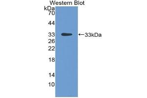Detection of Recombinant LBP, Rat using Polyclonal Antibody to Lipopolysaccharide Binding Protein (LBP) (LBP antibody  (AA 226-480))