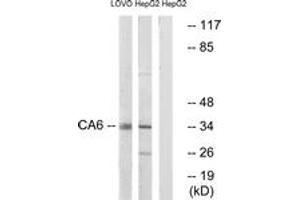 Western Blotting (WB) image for anti-Carbonic Anhydrase VI (CA6) (AA 231-280) antibody (ABIN2890191) (CA6 antibody  (AA 231-280))