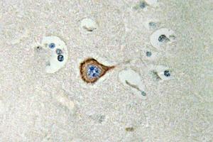 Immunohistochemistry (IHC) analyzes of CNPase antibody in paraffin-embedded human brain tissue. (Cnpase antibody)