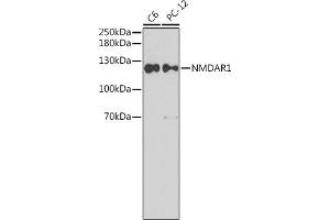 Western blot analysis of extracts of various cell lines, using NMD antibody (ABIN6133732, ABIN6141399, ABIN6141402 and ABIN7101806). (GRIN1/NMDAR1 antibody  (AA 600-700))