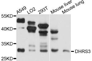 Western blot analysis of extracts of A375 cell line, using DHRS3 antibody. (DHRS3 antibody)
