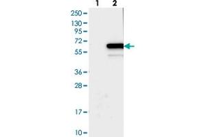 Western blot analysis of Lane 1: Negative control (vector only transfected HEK293T lysate), Lane 2: Over-expression Lysate (Co-expressed with a C-terminal myc-DDK tag (~3. (TTI2 antibody)