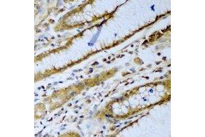 Immunohistochemical analysis of beta-TrCP staining in human stomach formalin fixed paraffin embedded tissue section. (beta-TrCP antibody)