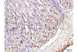 Immunohistochemistry (IHC) image for anti-Interferon Regulatory Factor 3 (IRF3) (pSer396) antibody (ABIN742688)