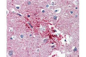 Anti-HMGN1 antibody IHC of human brain, cortex, senile plaque.