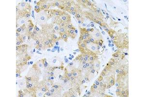 Immunohistochemistry of paraffin-embedded Human stomach using HDAC3 Polyclonal Antibody at dilution of 1:100 (40x lens). (HDAC3 antibody)