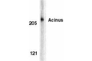 Western blot analysis of acinus in K562 whole cell lysate with AP30013PU-N Acinus antibody at 1 μg/ml. (ACIN1 antibody)