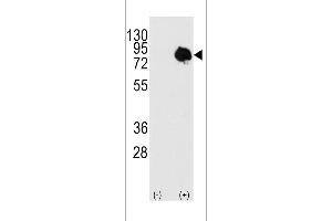 Western blot analysis of TGM2 using rabbit polyclonal using 293 cell lysates (2 ug/lane) either nontransfected (c) or transiently transfected with the TGM2 gene (Lane 2). (Transglutaminase antibody  (AA 413-442))