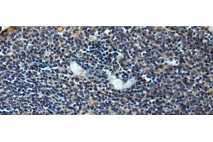 Immunohistochemistry of paraffin-embedded Human tonsil tissue using ERLIN1 Polyclonal Antibody at dilution of 1:50(x200) (ERLIN1 antibody)