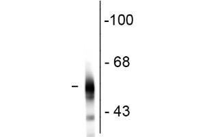 Western Blot - Mouse Anti-Tubulin B III antibody Western Blot of Mouse Anti-Tubulin ß III antibody. (TUBB3 antibody)