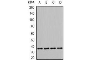 Western blot analysis of PDHB expression in Hela (A), Jurkat (B), mouse skeletal muscle (C), rat heart (D) whole cell lysates.