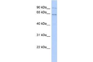 WB Suggested Anti-ZNF319 Antibody Titration:  0.