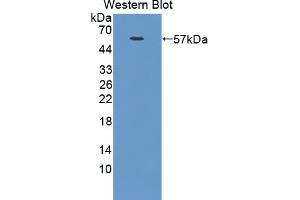 Figure. (NUAK1 antibody  (AA 404-651))