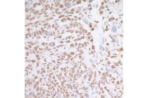 anti-MAD2 (AA 100-150) antibody