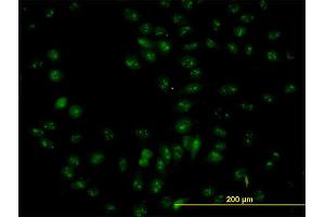 Immunofluorescence of purified MaxPab antibody to NOP56 on HeLa cell. (NOP56 antibody  (AA 49-174))