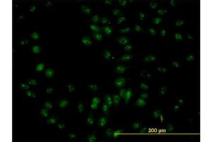 Immunofluorescence of purified MaxPab antibody to NOP56 on HeLa cell. (NOP56 antibody  (AA 49-174))