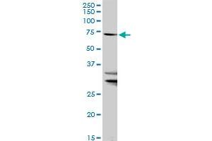SLC27A1 MaxPab rabbit polyclonal antibody. (SLC27A1 antibody  (AA 1-646))