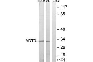 Western blot analysis of extracts from HepG2 cells and 293 cells, using SLC25A6 antibody. (SLC25A6 antibody  (Internal Region))