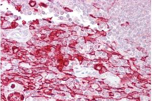 Immunohistochemistry (IHC) image for anti-Activating Transcription Factor 1 (AFT1) (Middle Region) antibody (ABIN2777262)