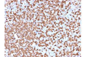 Formalin-fixed, paraffin-embedded human Spleen stained with CD74 Mouse Monoclonal Antibody (LN-2). (CD74 antibody)