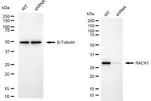 Western blotting analysis using RACK1 antibody (ABIN7798819).