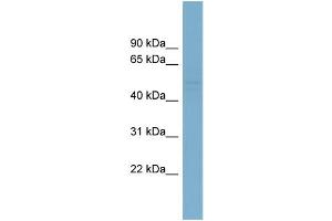 WB Suggested Anti-SMYD2  Antibody Titration: 0. (SMYD2A antibody  (N-Term))