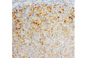 Anti-FGF8 antibody, IHC(P) IHC(P): Rat Ovary Tissue (FGF8 antibody  (C-Term))