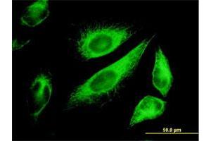 Immunofluorescence of monoclonal antibody to KRT18 on HeLa cell. (Cytokeratin 18 antibody  (AA 1-430))