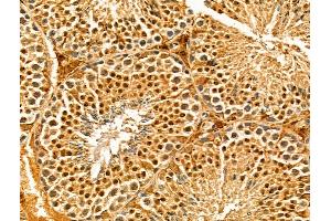 ABIN7094313 and ABIN7098360 at 1/100 staining Mouse testis tissue by IHC-P. (IWS1 antibody  (N-Term))