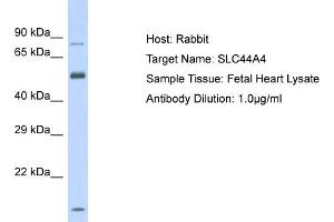 Host: Rabbit Target Name: SLC44A4 Sample Tissue: Human Fetal Heart Antibody Dilution: 1ug/ml