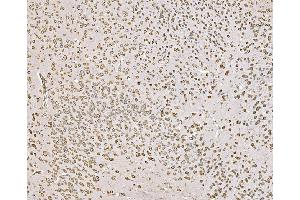 IHC analysis of SND1 using anti-SND1 antibody (ABIN7600525).