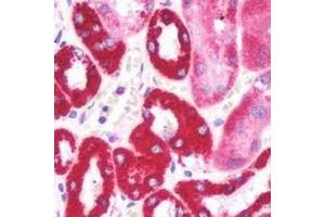 Immunohistochemical analysis of Aquaporin 2 staining in human kidney formalin fixed paraffin embedded tissue section. (AQP2 antibody  (C-Term))