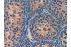 Detection of AGRP in Mouse Testis Tissue using Polyclonal Antibody to Agouti Related Protein (AGRP) (AGRP antibody  (AA 21-131))