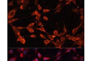 Immunofluorescence analysis of NIH/3T3 cells using SLC25A19 Polyclonal Antibody at dilution of 1:100. (SLC25A19 antibody)