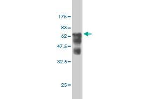 Western Blot detection against Immunogen (66 KDa) . (SMS antibody  (AA 1-366))