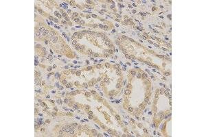 Immunohistochemistry of paraffin-embedded human kidney using BCL2L1 antibody at dilution of 1:200 (x400 lens) (BCL2L1 antibody  (AA 1-120))