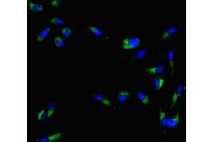 Immunofluorescent analysis of Hela cells using ABIN7160397 at dilution of 1:100 and Alexa Fluor 488-congugated AffiniPure Goat Anti-Rabbit IgG(H+L) (MAL antibody  (AA 1-84))