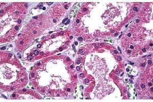Human Kidney: Formalin-Fixed, Paraffin-Embedded (FFPE) (SLC11A2 antibody  (AA 1-66))