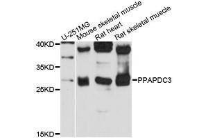 Western blot analysis of extracts of various cell lines, using PPAPDC3 antibody (ABIN6290295) at 1:3000 dilution. (PPAPDC3 antibody)