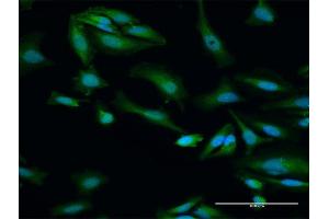 Immunofluorescence of purified MaxPab antibody to ORC6L on HeLa cell.