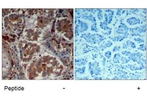 Image no. 2 for anti-Mechanistic Target of Rapamycin (serine/threonine Kinase) (mTOR) (Ser2448) antibody (ABIN319330) (MTOR antibody  (Ser2448))