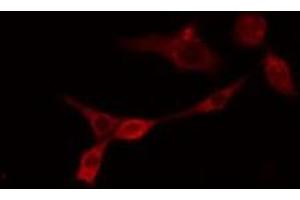 ABIN6275565 staining RAW264. (SHANK2 antibody  (Internal Region))