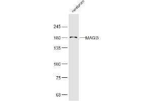 Mouse cerebrum lysates probed with MAGI3 Polyclonal Antibody, Unconjugated  at 1:300 dilution and 4˚C overnight incubation.