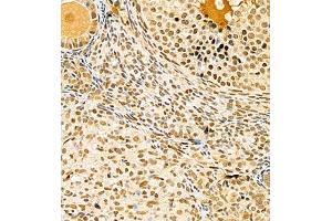 Immunohistochemistry (Paraffin-embedded Sections) (IHC (p)) image for anti-Nuclear Receptor Coactivator 3 (NCOA3) antibody (ABIN7074886)