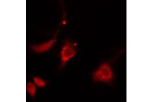ABIN6274873 staining HepG2 cells by IF/ICC. (ATP5H antibody  (C-Term))